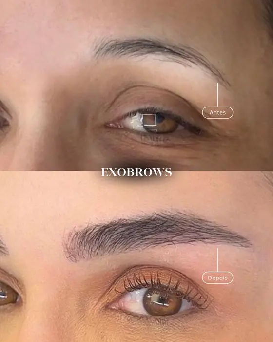 ExoBrows, before and after