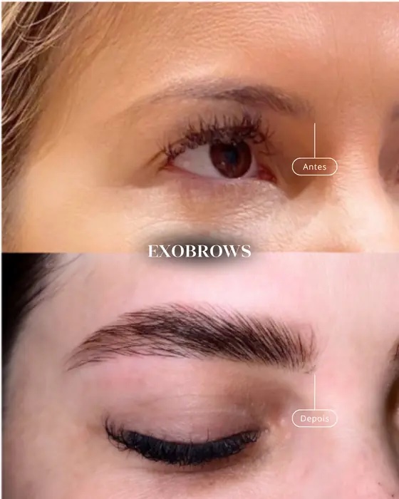 ExoBrows, before and after