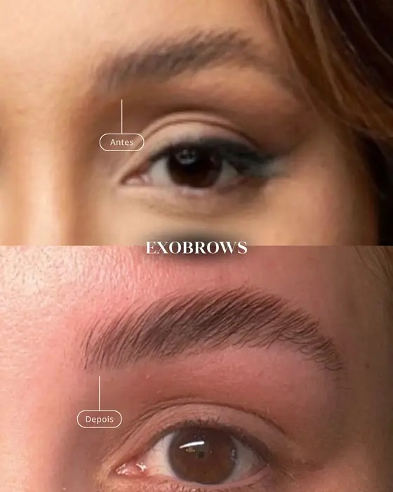 ExoBrows, before and after