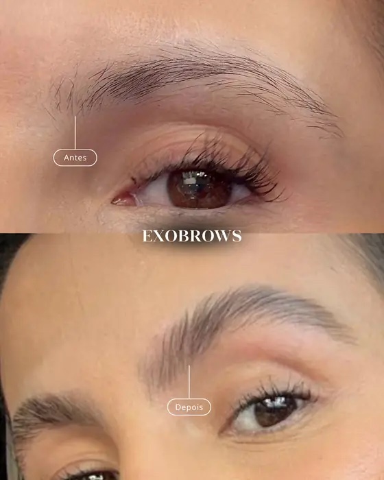 ExoBrows, before and after